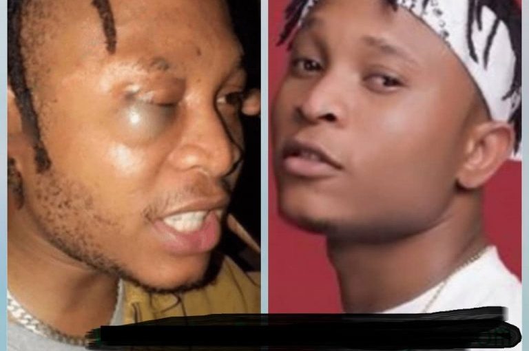 Viktoh: ‘See My Face, Police Punched My Eyes!”, Nigerians React To Assault On Singer